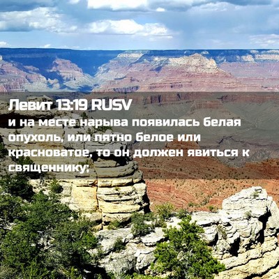 Picture 02 - Левит 13:19 RUSV - и на месте нарыва - Bible Verse Picture