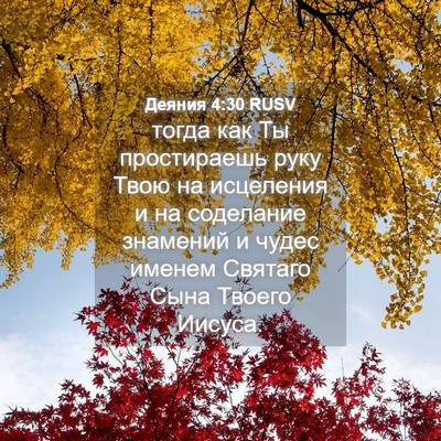 Picture 04 - Деяния 4:30 RUSV - тогда как Ты простираешь - Bible Verse Picture