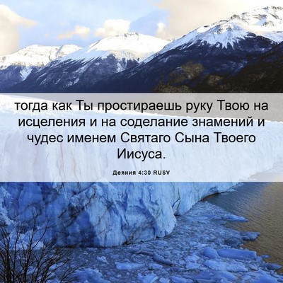 Picture 06 - Деяния 4:30 RUSV - тогда как Ты простираешь - Bible Verse Picture