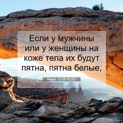 Picture 07 - Левит 13:38 RUSV - Если у мужчины или у - Bible Verse Picture